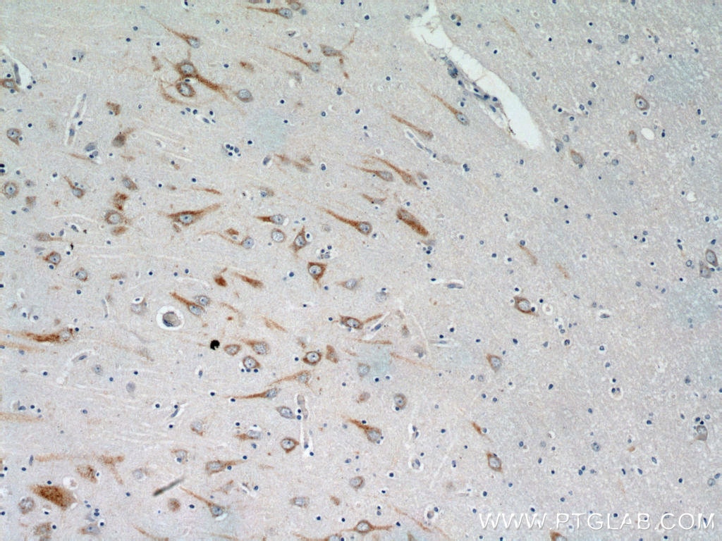 Immunohistochemistry (IHC) staining of human brain tissue using HTR6 Polyclonal antibody (23561-1-AP)