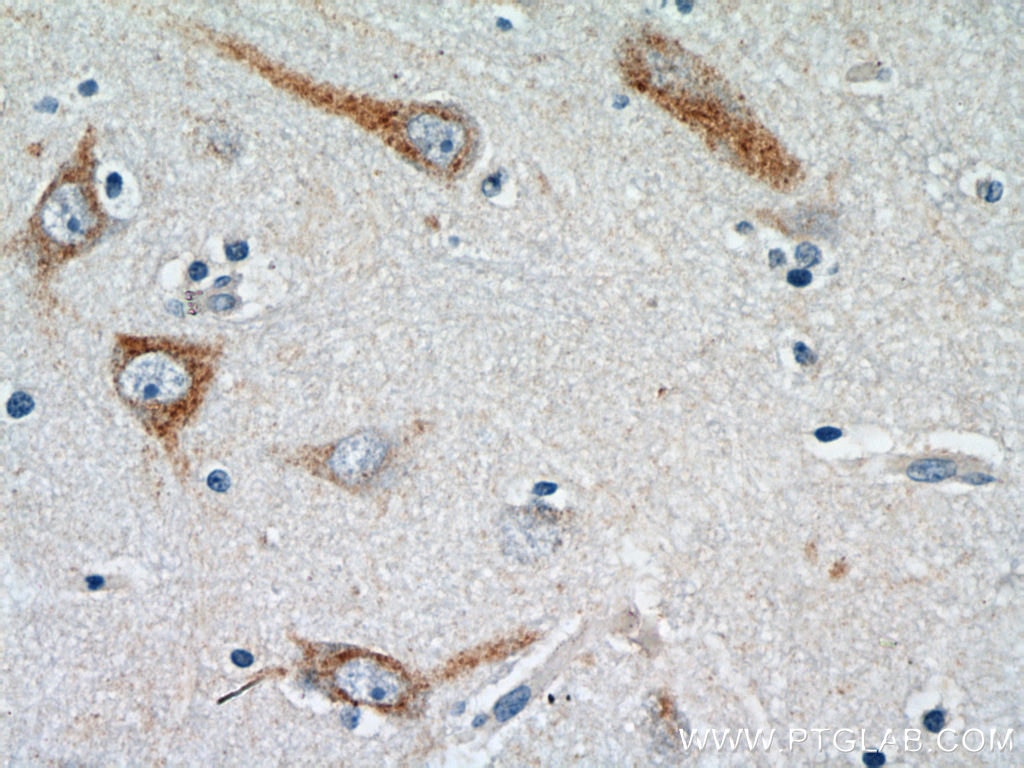 Immunohistochemistry (IHC) staining of human brain tissue using HTR6 Polyclonal antibody (23561-1-AP)