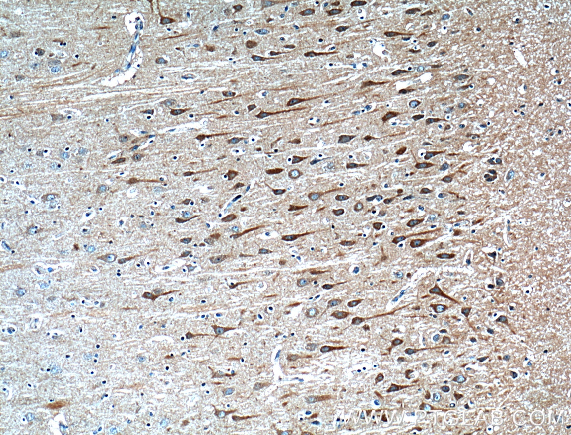 Immunohistochemistry (IHC) staining of human brain tissue using HTR7 Polyclonal antibody (13830-1-AP)