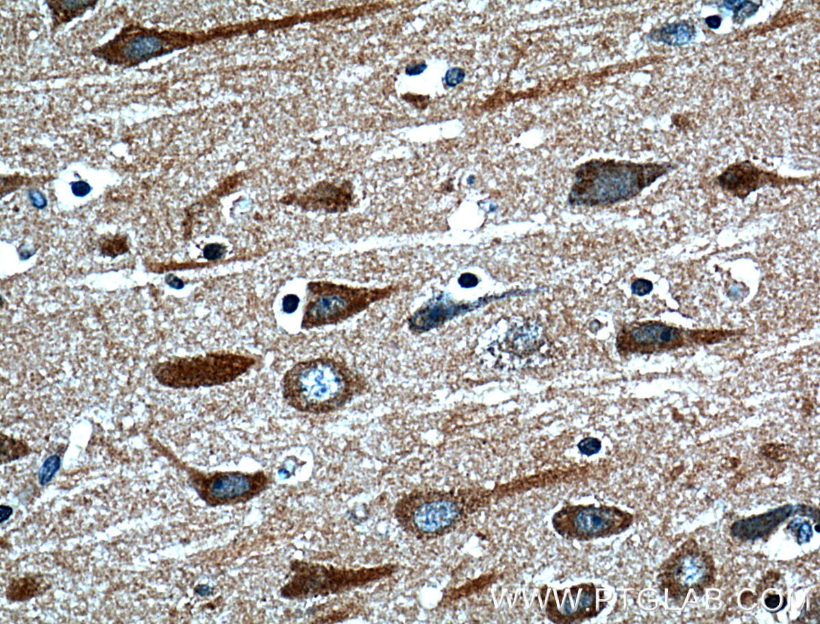 Immunohistochemistry (IHC) staining of human brain tissue using HTR7 Polyclonal antibody (13830-1-AP)