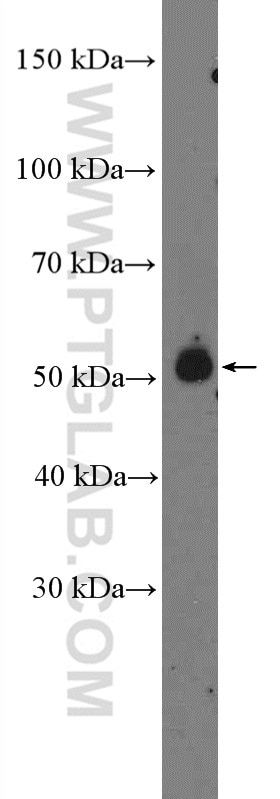Western Blot (WB) analysis of mouse brain tissue using HTR7 Polyclonal antibody (13830-1-AP)