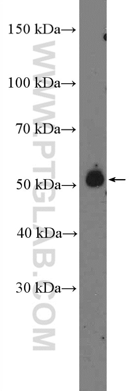 WB analysis of mouse brain using 13830-1-AP