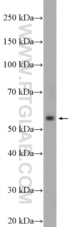 Western Blot (WB) analysis of mouse spleen tissue using HTR7 Polyclonal antibody (13830-1-AP)
