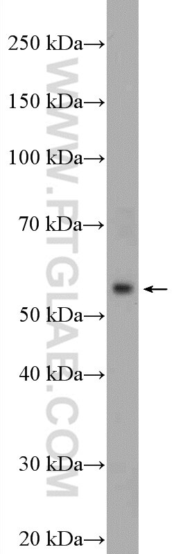 WB analysis of mouse spleen using 13830-1-AP