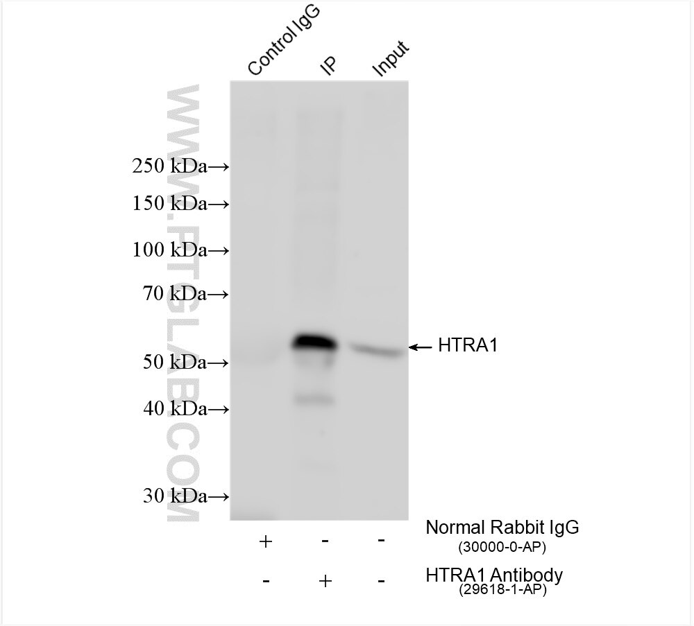 Immunoprecipitation (IP) experiment of human placenta tissue using HTRA1 Polyclonal antibody (29618-1-AP)
