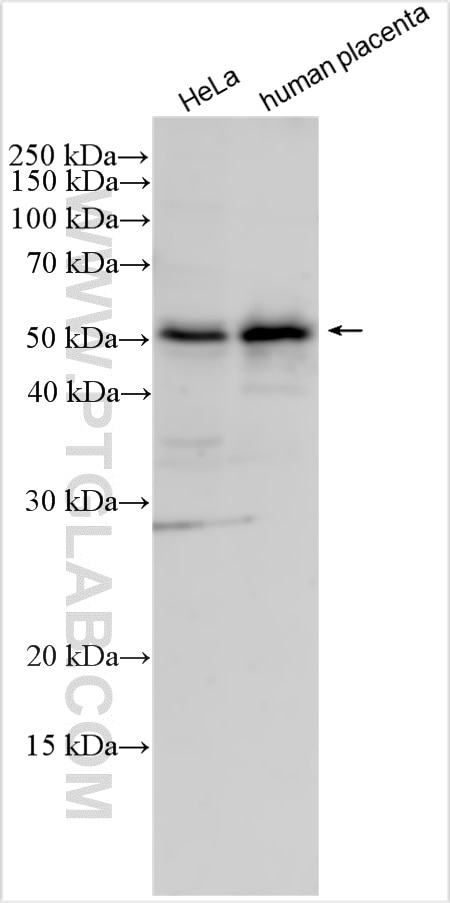 WB analysis using 29618-1-AP