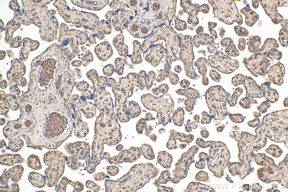 Immunohistochemistry (IHC) staining of human placenta tissue using HTRA1 Polyclonal antibody (55011-1-AP)