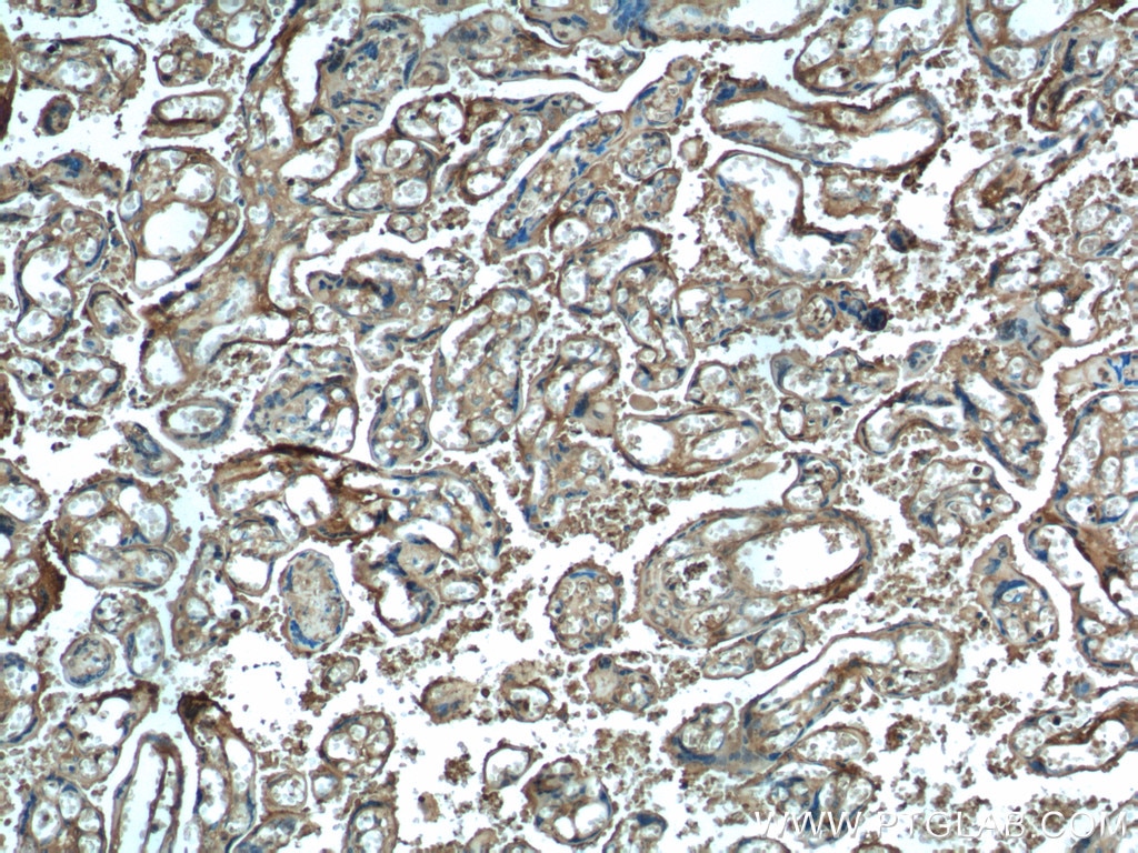 Immunohistochemistry (IHC) staining of human placenta tissue using HTRA1 Polyclonal antibody (55011-1-AP)