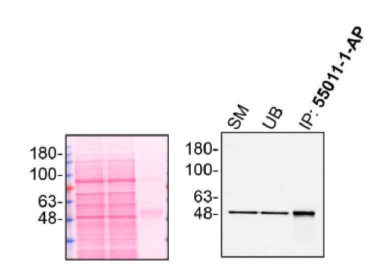 Immunoprecipitation (IP) experiment of HAP1 cells using HTRA1 Polyclonal antibody (55011-1-AP)