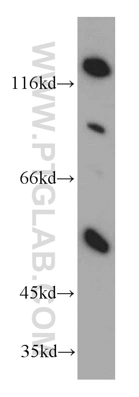Western Blot (WB) analysis of mouse brain tissue using HTRA1 Polyclonal antibody (55011-1-AP)