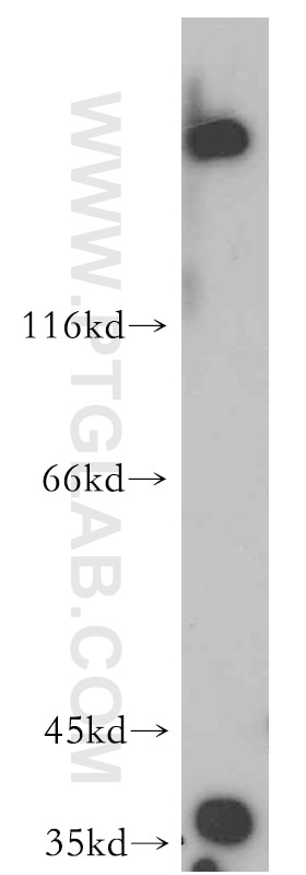 WB analysis of HepG2 using 55011-1-AP