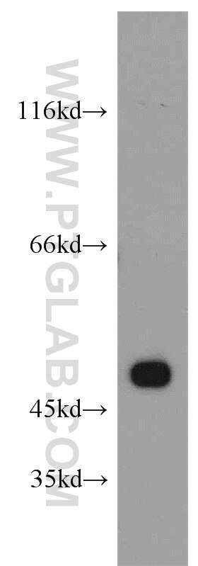 Western Blot (WB) analysis of mouse brain tissue using HTRA1 Polyclonal antibody (55011-1-AP)