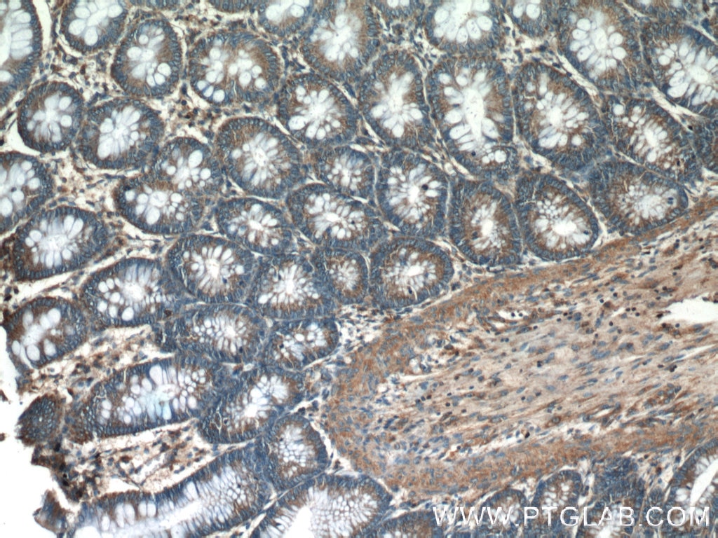 Immunohistochemistry (IHC) staining of human colon tissue using HTRA2 Polyclonal antibody (15775-1-AP)