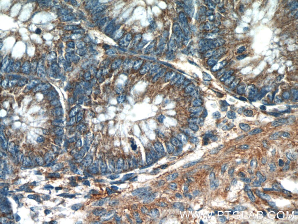 IHC staining of human colon using 15775-1-AP