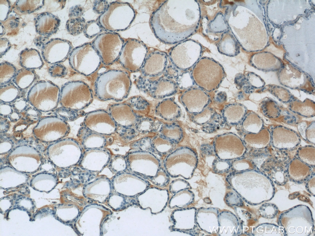 Immunohistochemistry (IHC) staining of human thyroid tissue using HTRA2 Polyclonal antibody (15775-1-AP)