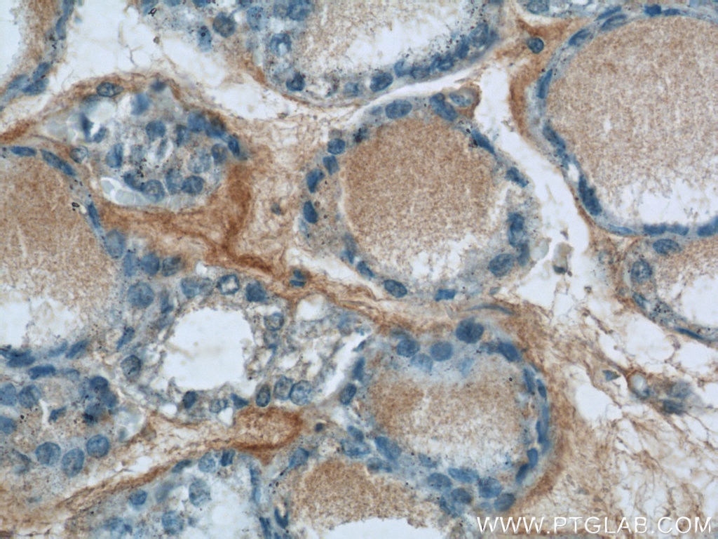 Immunohistochemistry (IHC) staining of human thyroid tissue using HTRA2 Polyclonal antibody (15775-1-AP)