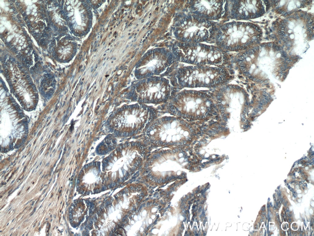 Immunohistochemistry (IHC) staining of human colon tissue using HTRA2 Polyclonal antibody (15775-1-AP)