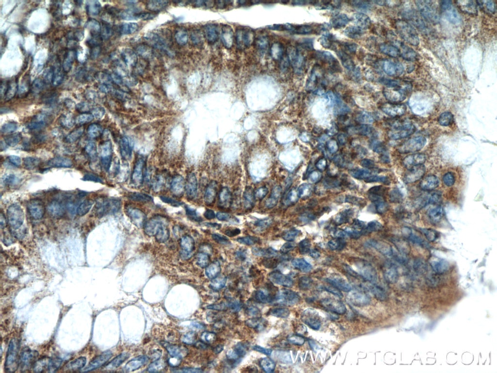 Immunohistochemistry (IHC) staining of human colon tissue using HTRA2 Polyclonal antibody (15775-1-AP)