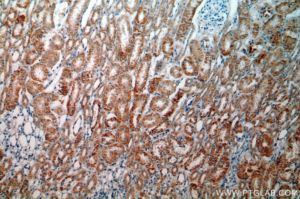 Immunohistochemistry (IHC) staining of human kidney tissue using HTRA2 Polyclonal antibody (15775-1-AP)