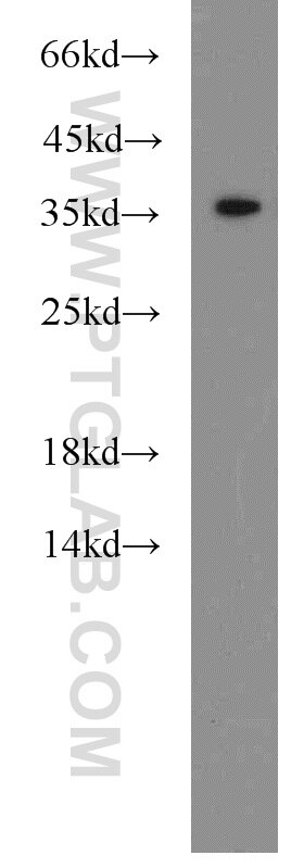 HTRA2 Polyclonal antibody