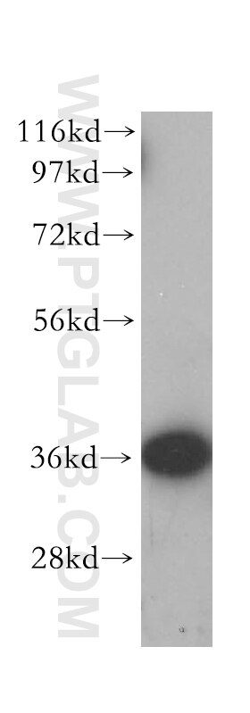 Western Blot (WB) analysis of human heart tissue using HTRA2 Polyclonal antibody (15775-1-AP)