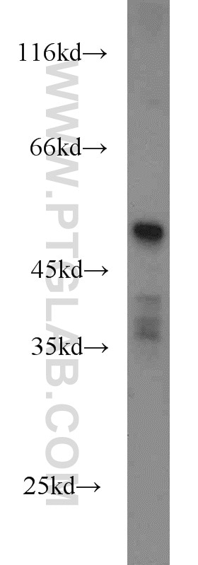 Western Blot (WB) analysis of human placenta tissue using HTRA4 Polyclonal antibody (14095-1-AP)