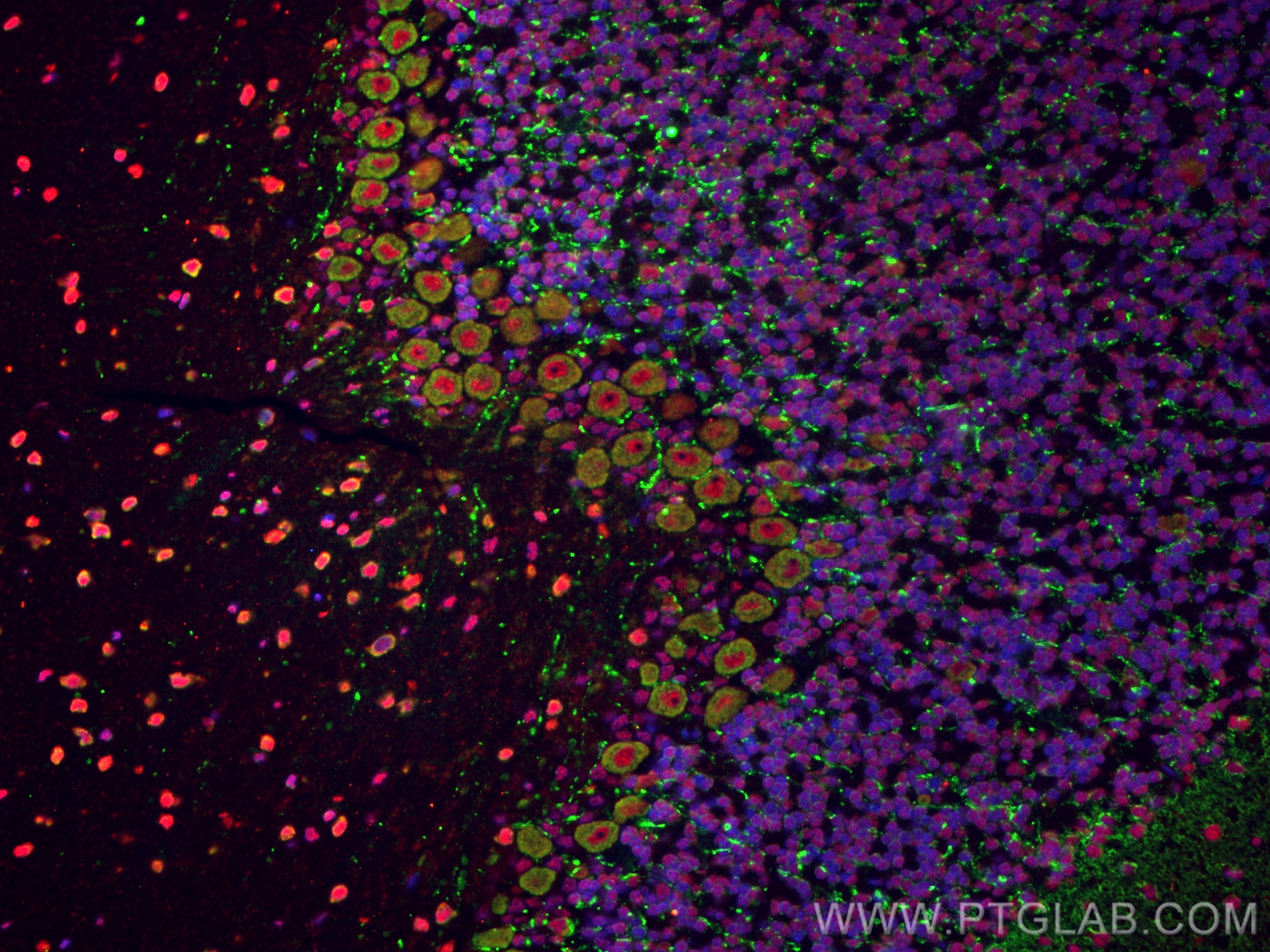 Immunofluorescence (IF) / fluorescent staining of rat cerebellum tissue using Huntingtin Polyclonal antibody (19957-1-AP)