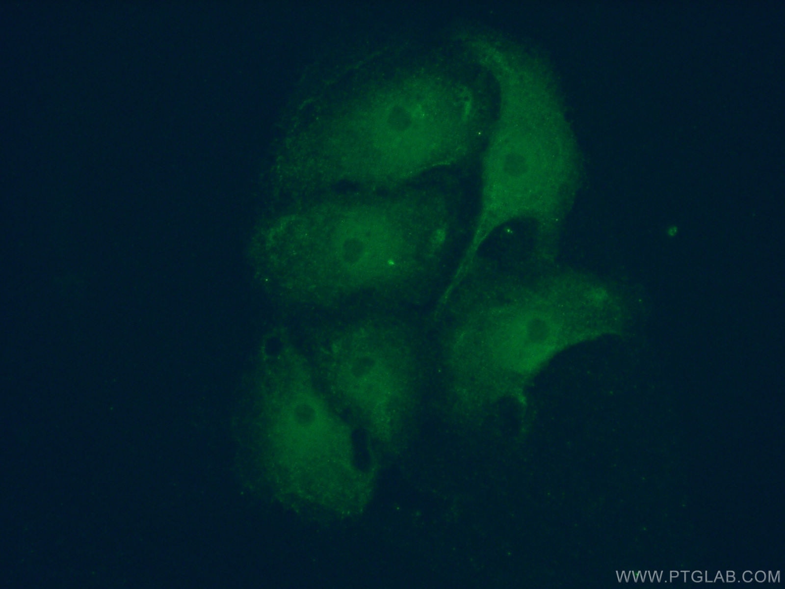 Immunofluorescence (IF) / fluorescent staining of SH-SY5Y cells using Huntingtin Polyclonal antibody (19957-1-AP)
