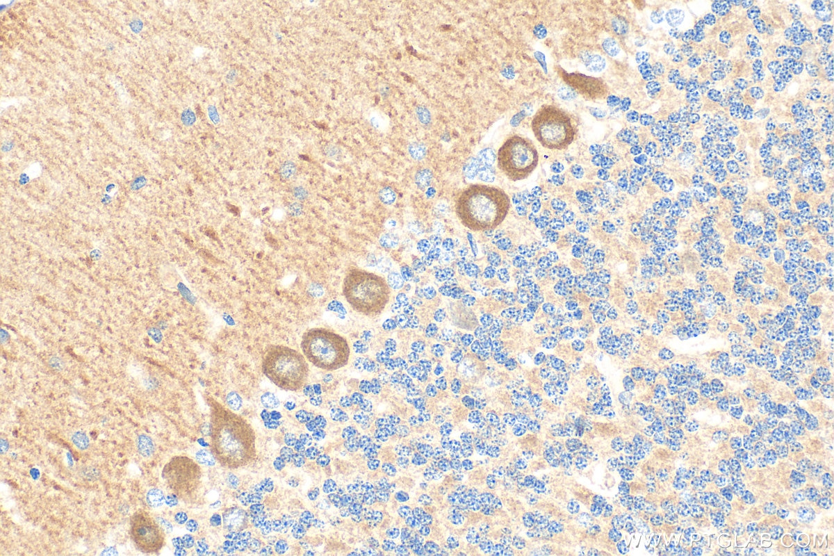 Immunohistochemistry (IHC) staining of rat cerebellum tissue using Huntingtin Polyclonal antibody (19957-1-AP)