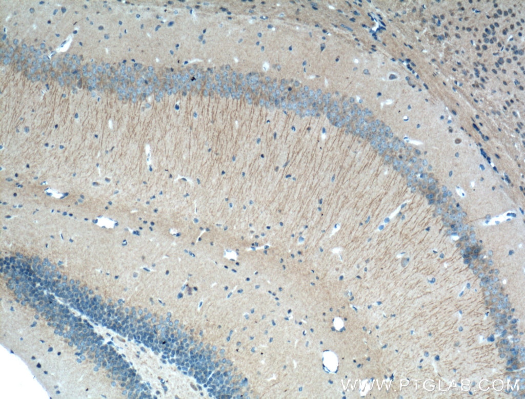 Immunohistochemistry (IHC) staining of mouse brain tissue using Huntingtin Polyclonal antibody (19957-1-AP)