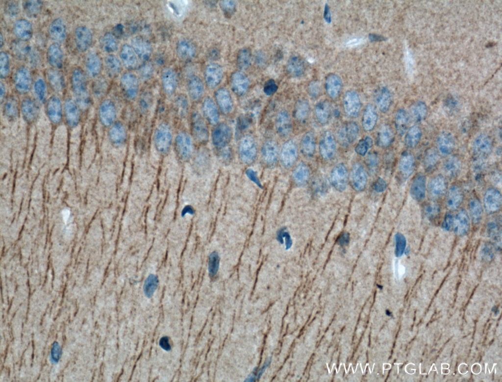 Immunohistochemistry (IHC) staining of mouse brain tissue using Huntingtin Polyclonal antibody (19957-1-AP)