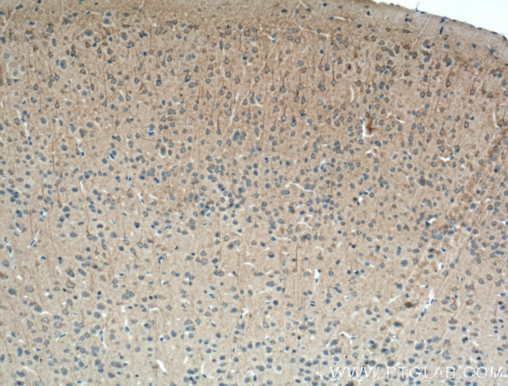 Immunohistochemistry (IHC) staining of mouse brain tissue using Huntingtin Polyclonal antibody (19957-1-AP)