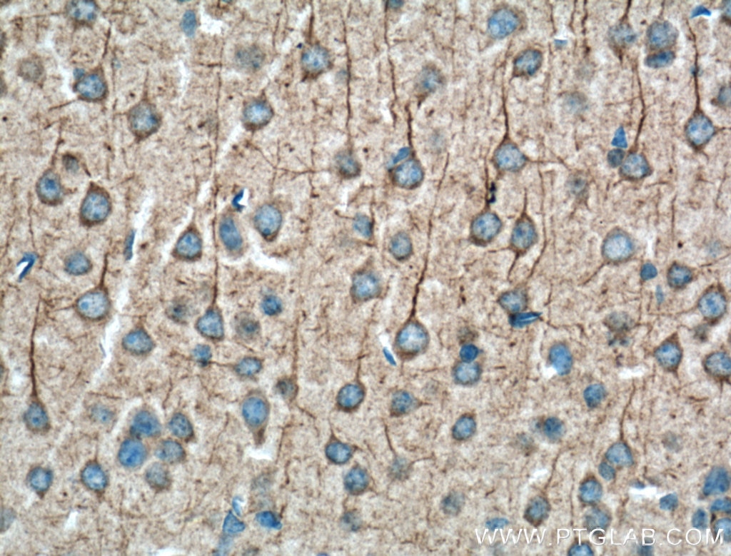 Immunohistochemistry (IHC) staining of mouse brain tissue using Huntingtin Polyclonal antibody (19957-1-AP)