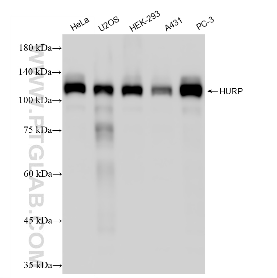 Various lysates were subjected to SDS PAGE followed by western blot with 86704-1-RR (HURP antibody) at dilution of 1:30000 incubated at room temperature for 1.5 hours. Western Blot (WB) analysis of various lysates using HURP Recombinant monoclonal antibody (86704-1-RR)