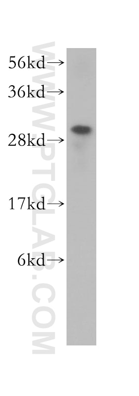 WB analysis of BxPC-3 using 11223-1-AP