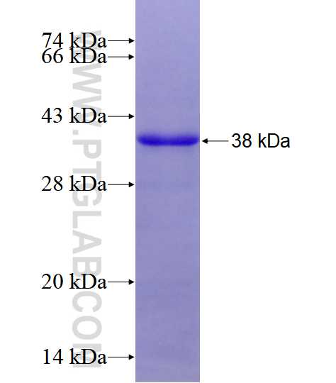 HUS1 fusion protein Ag28527 SDS-PAGE