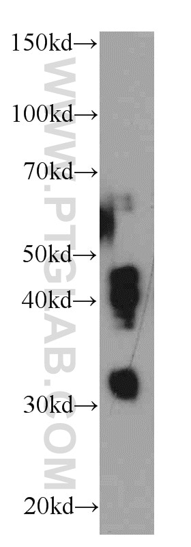 Western Blot (WB) analysis of PC-3 cells using HUS1B Polyclonal antibody (18229-1-AP)