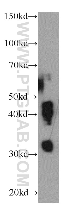 WB analysis of PC-3 using 18229-1-AP