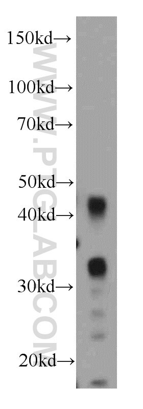 Western Blot (WB) analysis of human stomach tissue using HUS1B Polyclonal antibody (18229-1-AP)