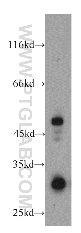 Western Blot (WB) analysis of RAW264.7 using HUS1B Polyclonal antibody (18229-1-AP)
