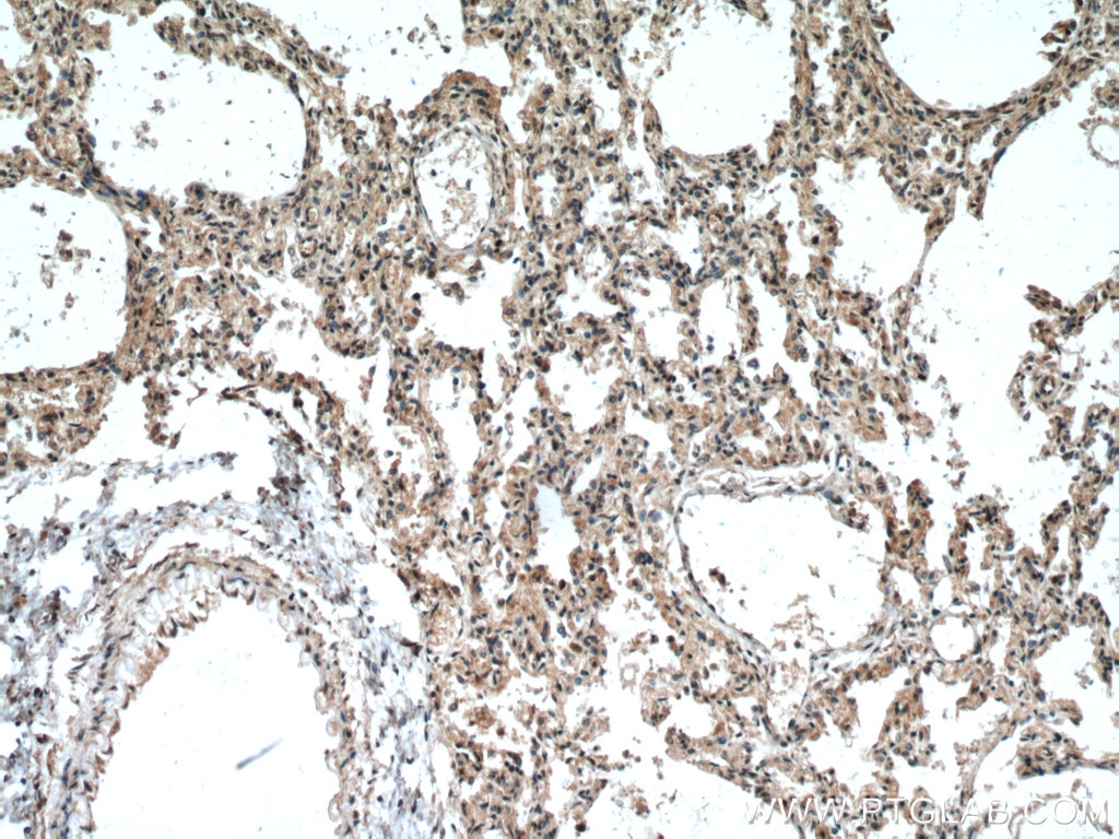 Immunohistochemistry (IHC) staining of human lung tissue using HUWE1 Polyclonal antibody (19430-1-AP)