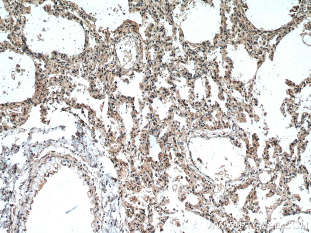 IHC staining of human lung using 19430-1-AP