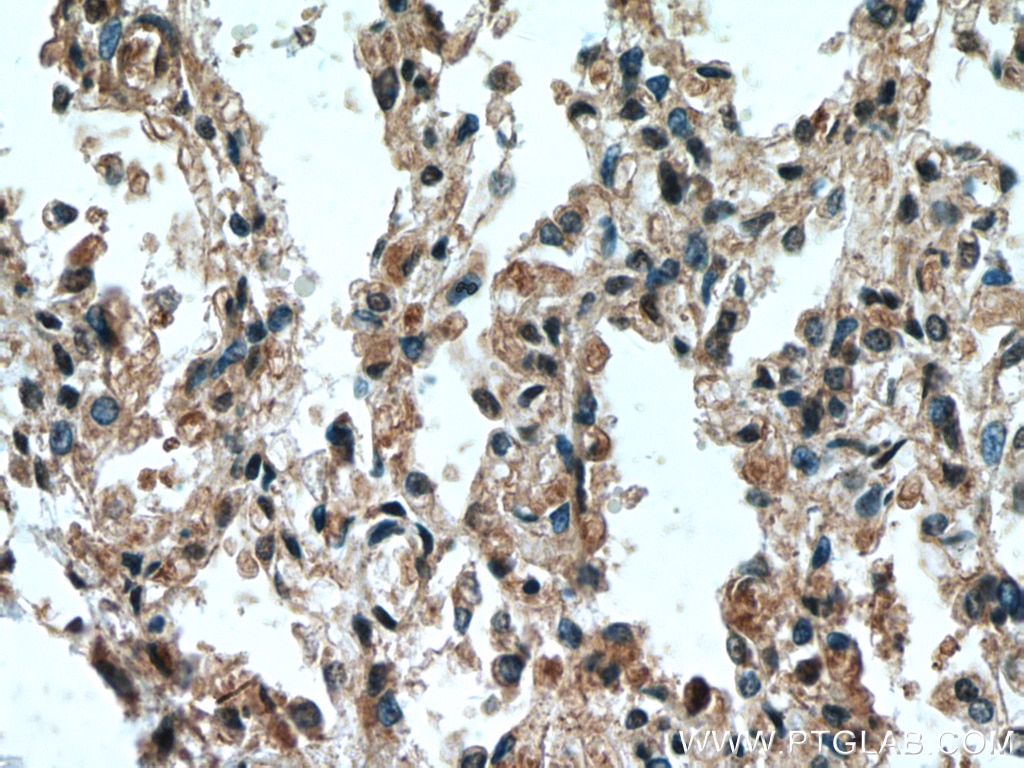 IHC staining of human lung using 19430-1-AP