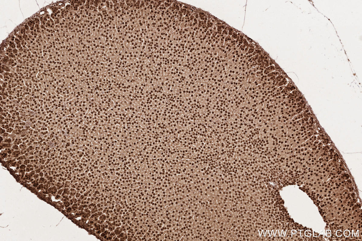 Immunohistochemistry (IHC) staining of mouse adrenal gland tissue using HUWE1 Polyclonal antibody (19430-1-AP)