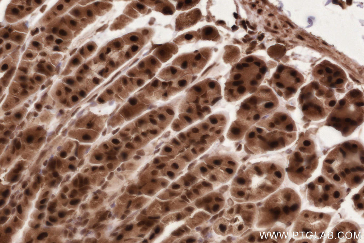 Immunohistochemistry (IHC) staining of mouse stomach tissue using HUWE1 Polyclonal antibody (19430-1-AP)