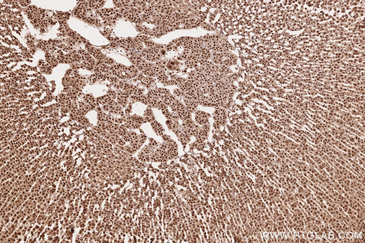 Immunohistochemistry (IHC) staining of rat adrenal gland tissue using HUWE1 Polyclonal antibody (19430-1-AP)