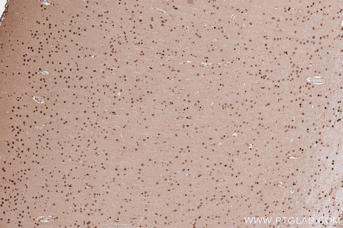 Immunohistochemistry (IHC) staining of rat brain tissue using HUWE1 Polyclonal antibody (19430-1-AP)