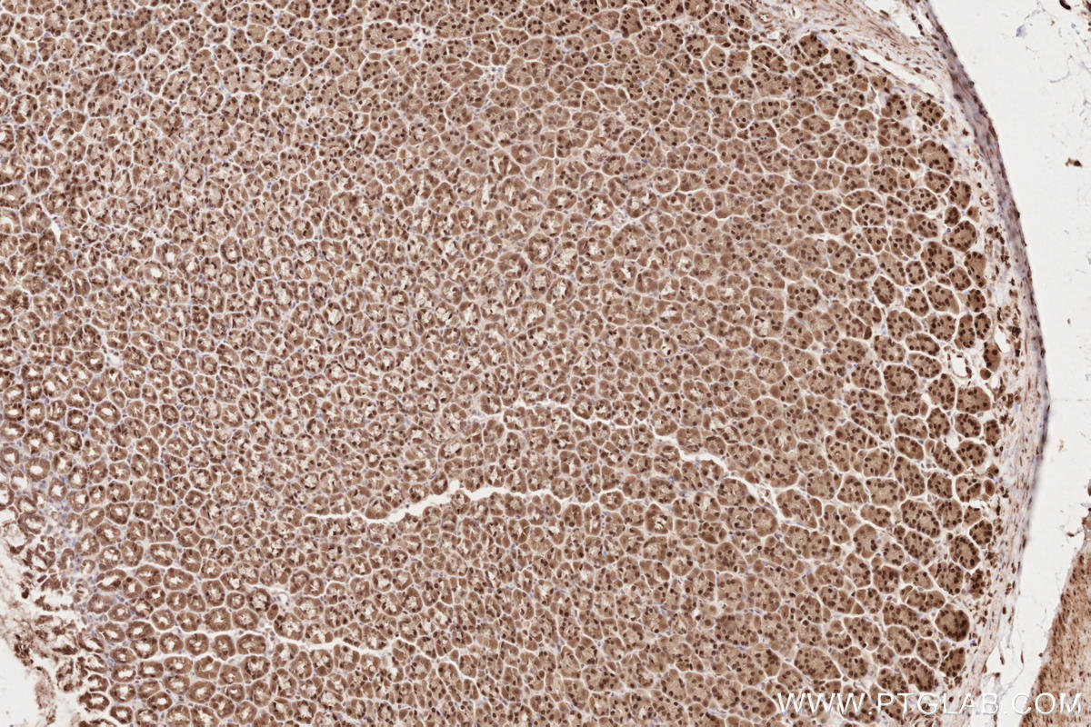 Immunohistochemistry (IHC) staining of rat stomach tissue using HUWE1 Polyclonal antibody (19430-1-AP)