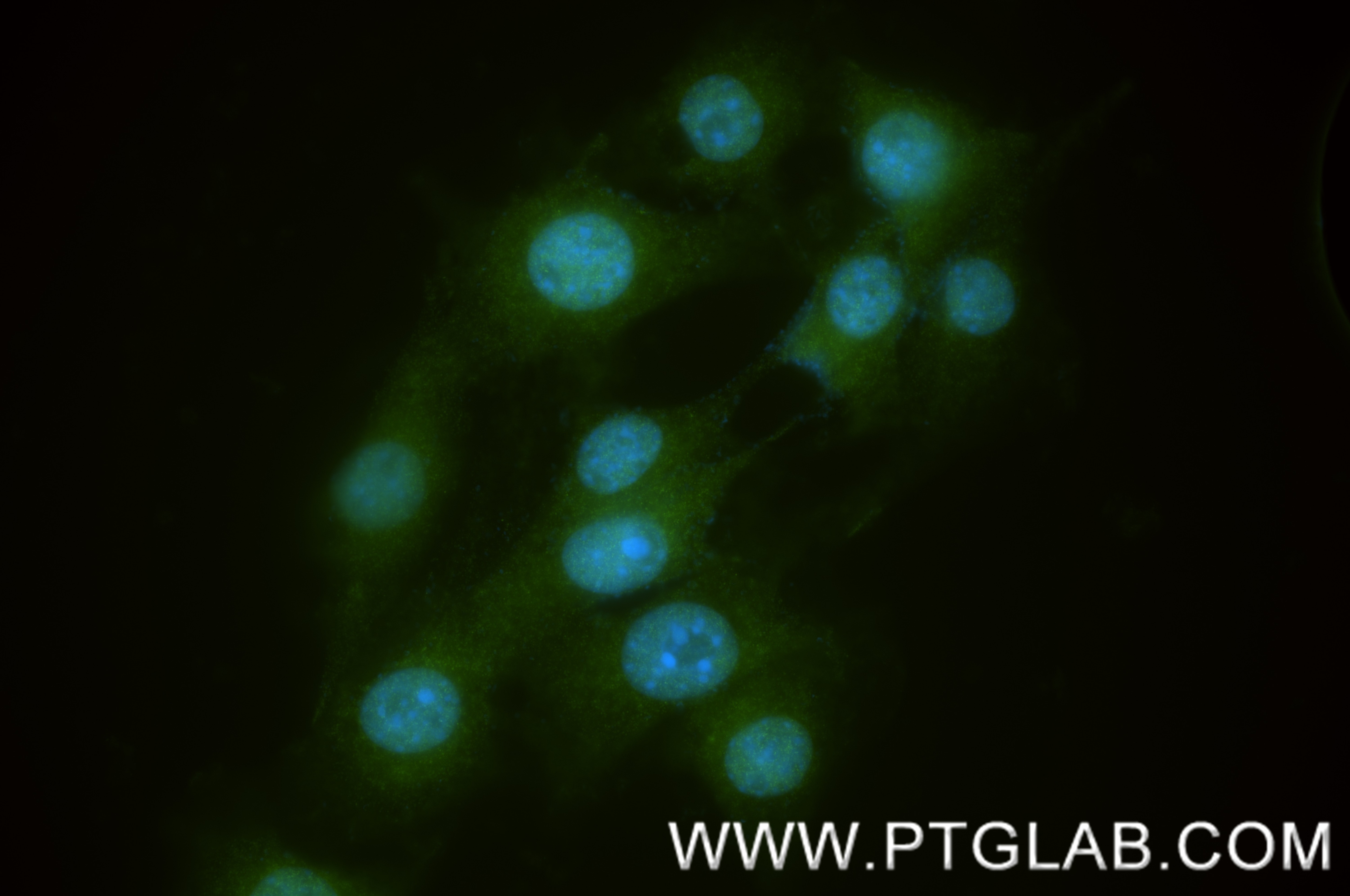 Immunofluorescence (IF) / fluorescent staining of NIH/3T3 cells using HUWE1 Recombinant monoclonal antibody (85177-3-RR)