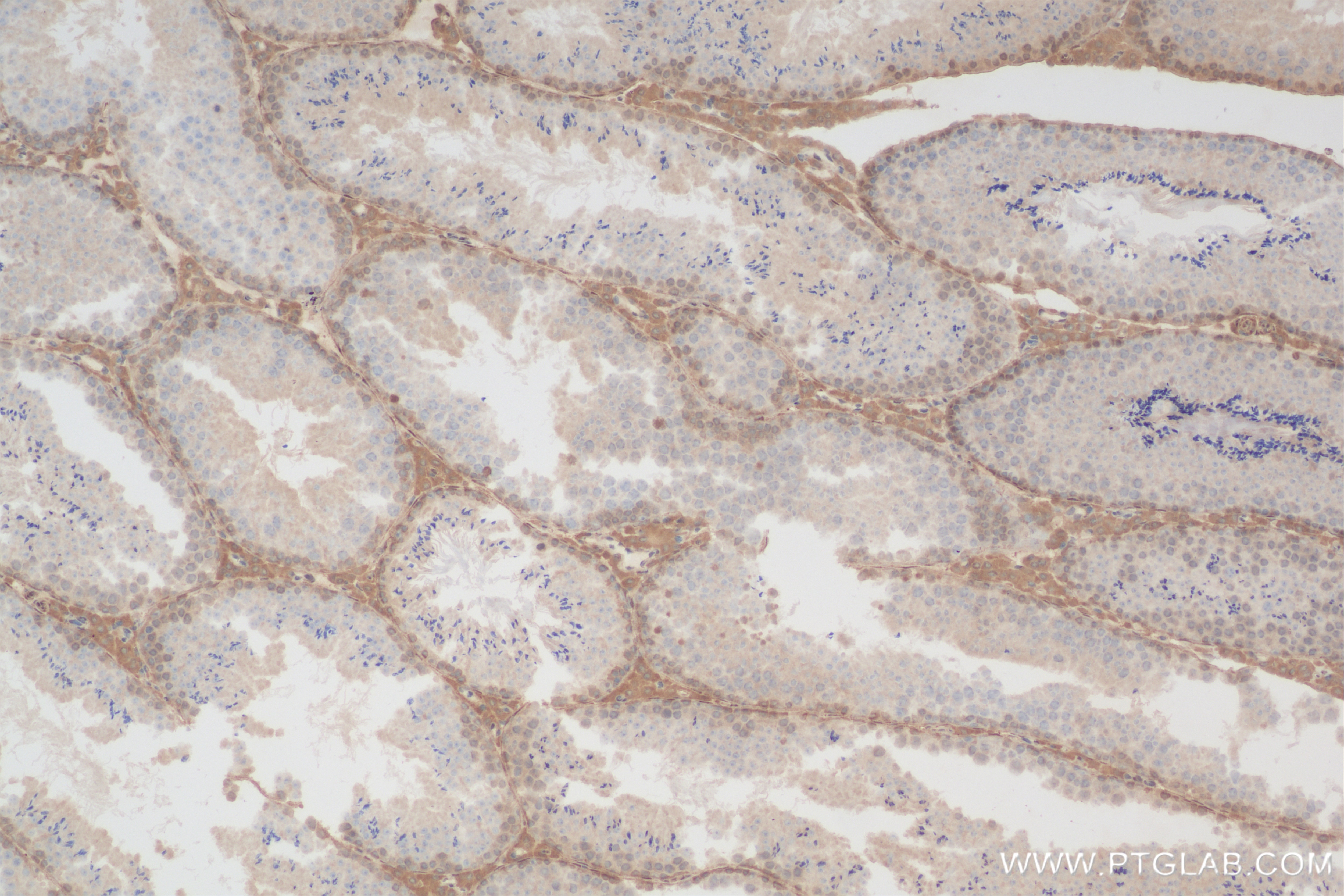 Immunohistochemistry (IHC) staining of mouse testis tissue using HUWE1 Recombinant antibody (85177-3-RR)